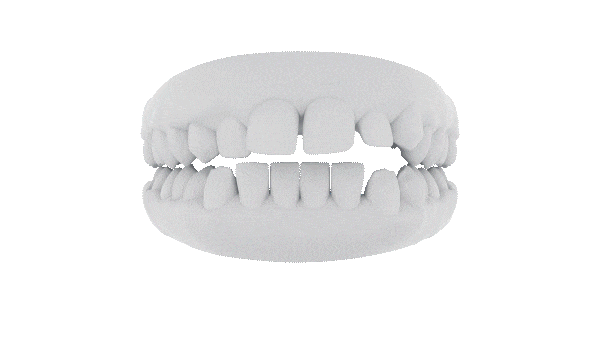 animated tooth
