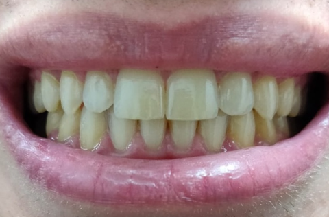 After condition