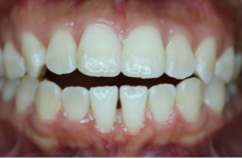 Before condition