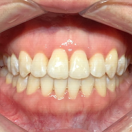 Image two